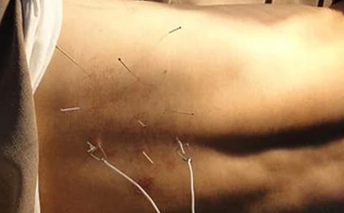 針灸科實習的心得體會范文