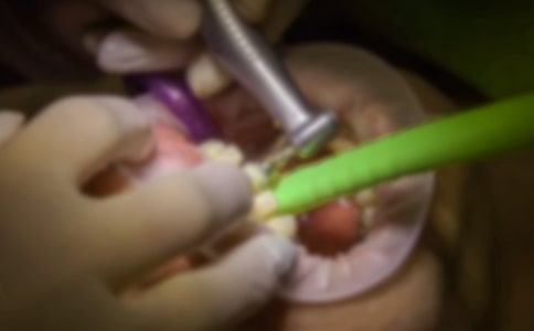 ���᡿����ӛ15ƪ