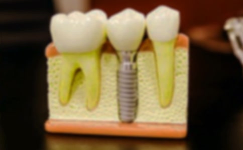 第一次拔牙作文(匯編15篇)