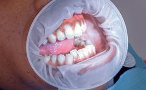 �L���X��(d��o)�µ����l�[ʹ��ô�k